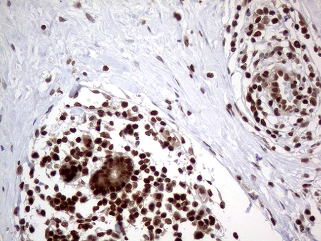 MGMT Antibody in Immunohistochemistry (Paraffin) (IHC (P))