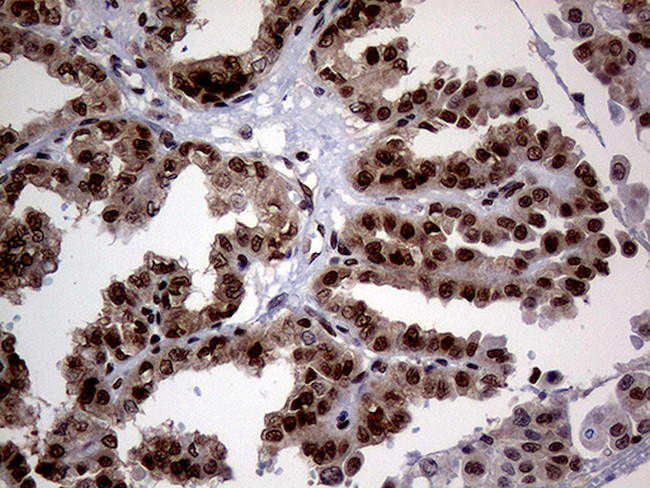 MGMT Antibody in Immunohistochemistry (Paraffin) (IHC (P))