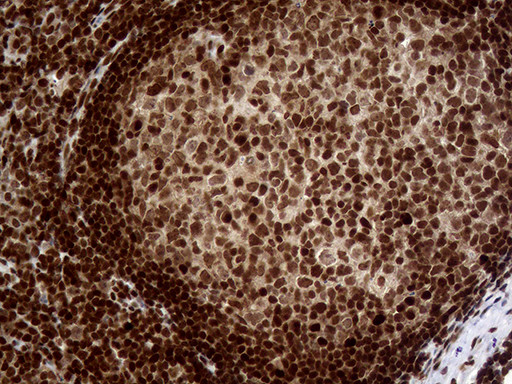 MGMT Antibody in Immunohistochemistry (Paraffin) (IHC (P))