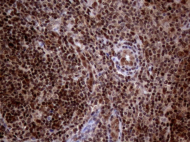 MGMT Antibody in Immunohistochemistry (Paraffin) (IHC (P))