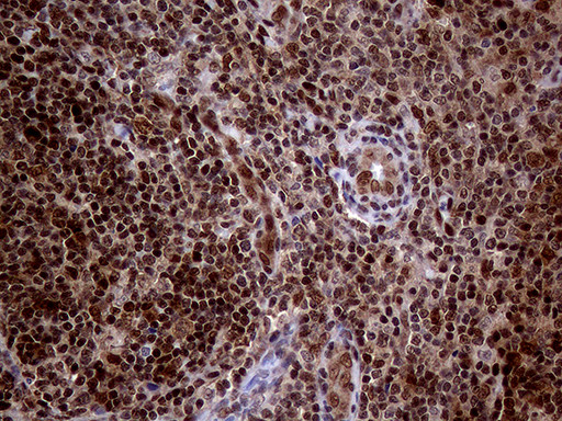 MGMT Antibody in Immunohistochemistry (Paraffin) (IHC (P))