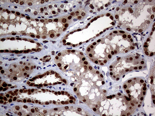 MGMT Antibody in Immunohistochemistry (Paraffin) (IHC (P))