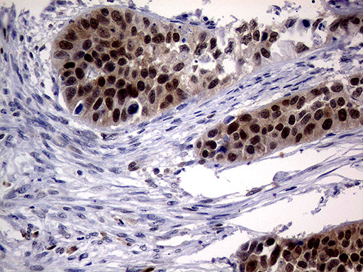 MGMT Antibody in Immunohistochemistry (Paraffin) (IHC (P))