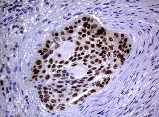 MGMT Antibody in Immunohistochemistry (Paraffin) (IHC (P))