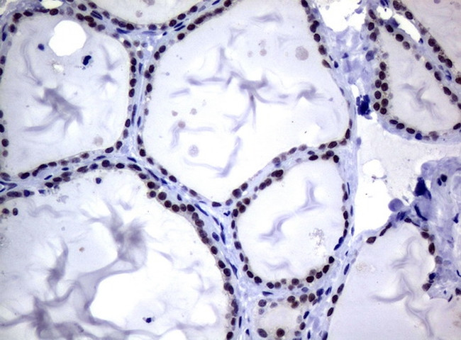 MGMT Antibody in Immunohistochemistry (Paraffin) (IHC (P))