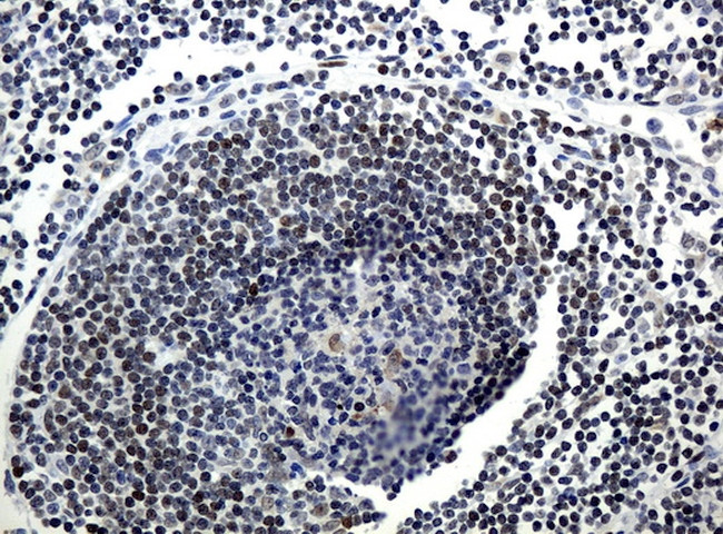 MGMT Antibody in Immunohistochemistry (Paraffin) (IHC (P))