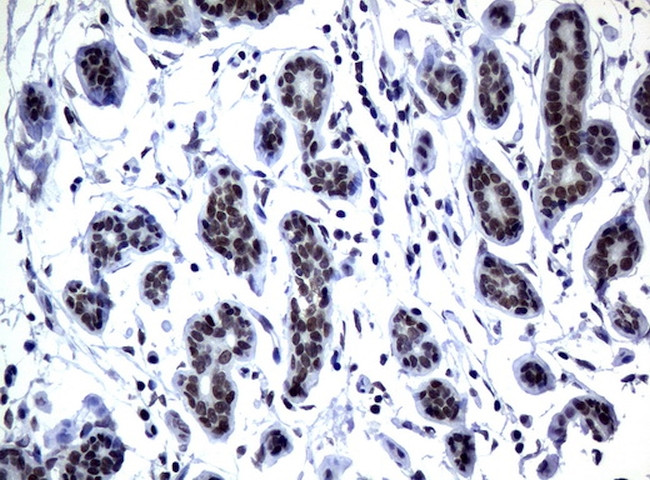 MGMT Antibody in Immunohistochemistry (Paraffin) (IHC (P))