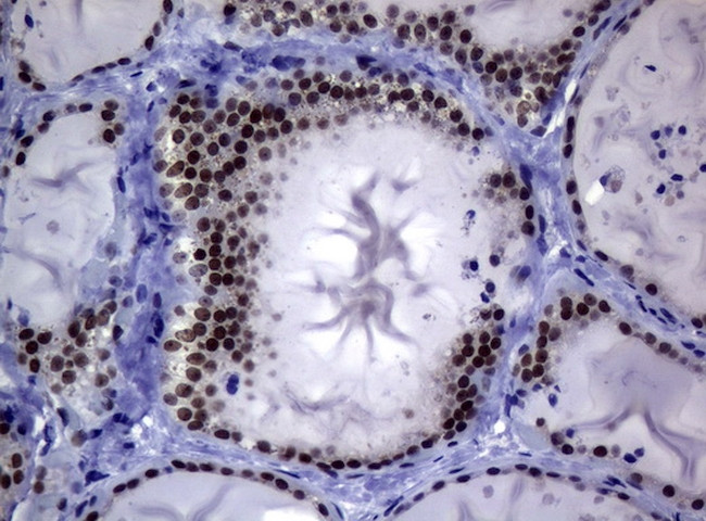 MGMT Antibody in Immunohistochemistry (Paraffin) (IHC (P))