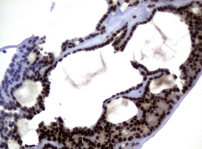 MGMT Antibody in Immunohistochemistry (Paraffin) (IHC (P))