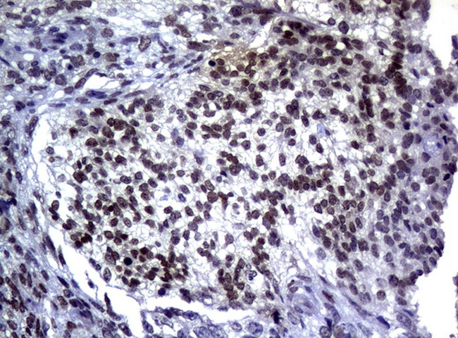 MGMT Antibody in Immunohistochemistry (Paraffin) (IHC (P))