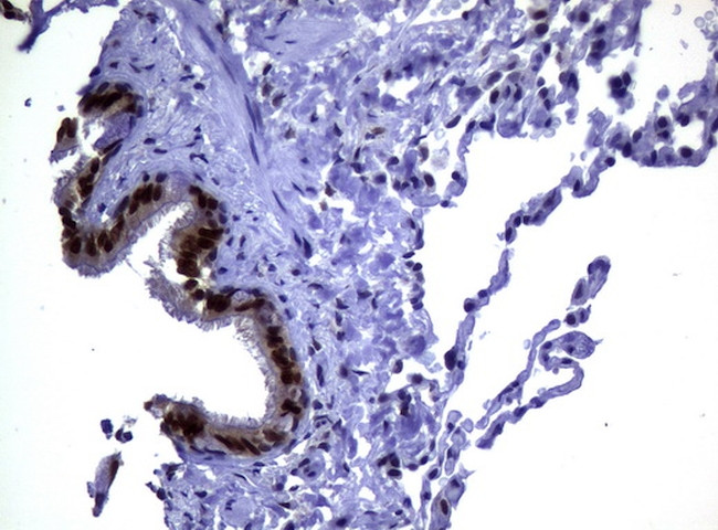 MGMT Antibody in Immunohistochemistry (Paraffin) (IHC (P))