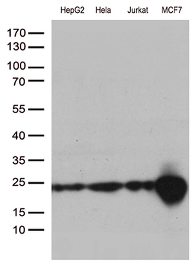 MGMT Antibody in Western Blot (WB)