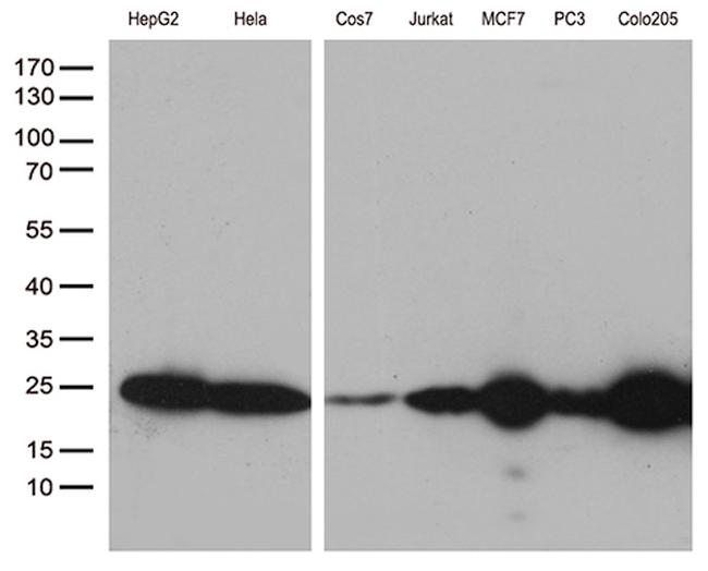 MGMT Antibody in Western Blot (WB)