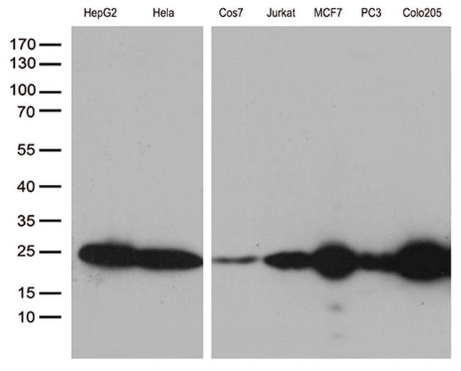 MGMT Antibody in Western Blot (WB)