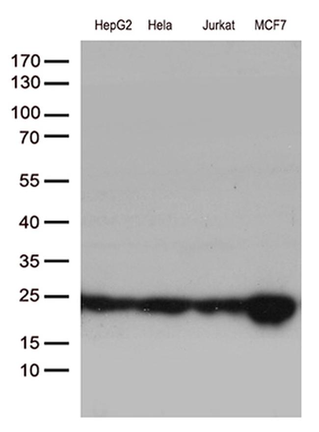 MGMT Antibody in Western Blot (WB)