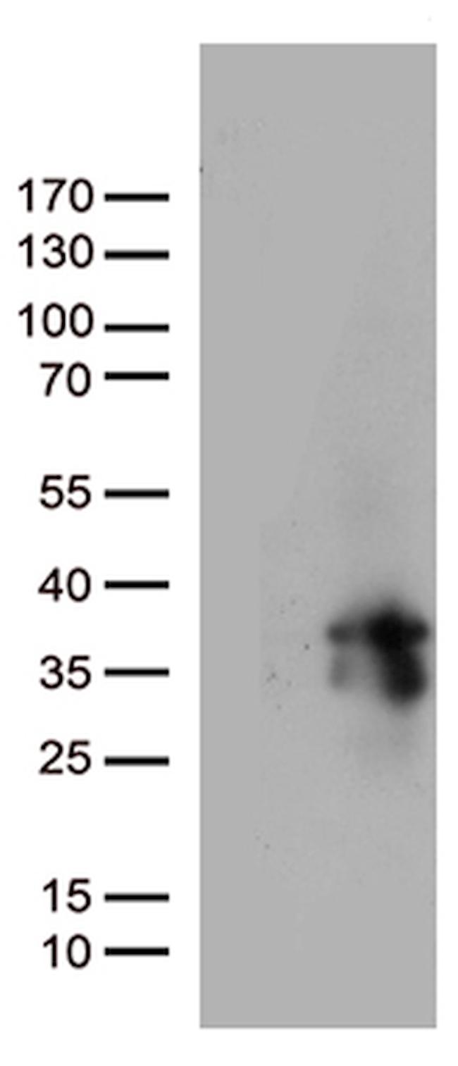 MGMT Antibody in Western Blot (WB)