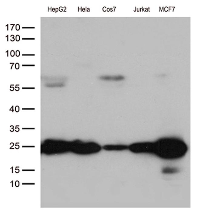 MGMT Antibody in Western Blot (WB)