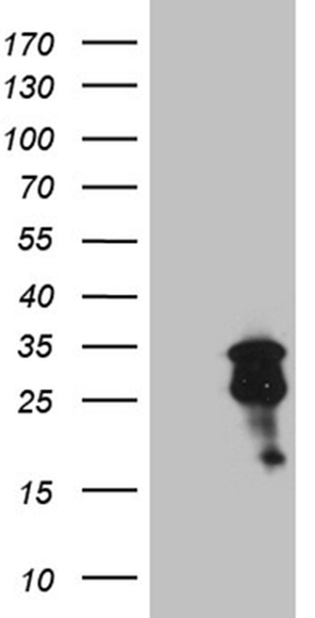 MGMT Antibody in Western Blot (WB)