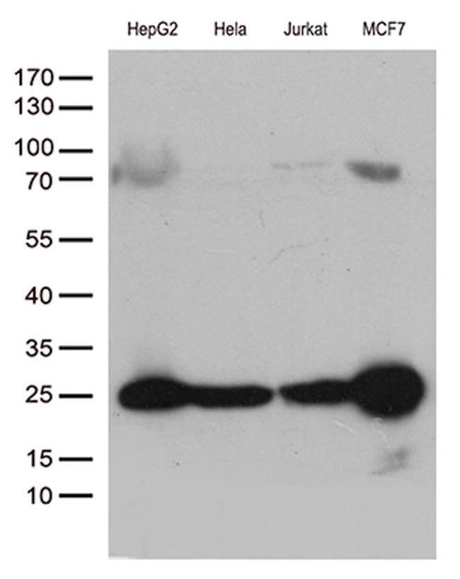 MGMT Antibody in Western Blot (WB)