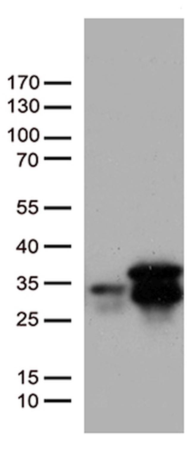 MGMT Antibody in Western Blot (WB)