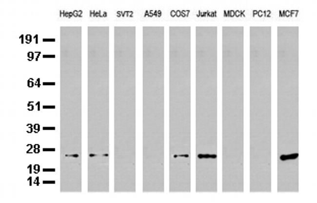 MGMT Antibody in Western Blot (WB)