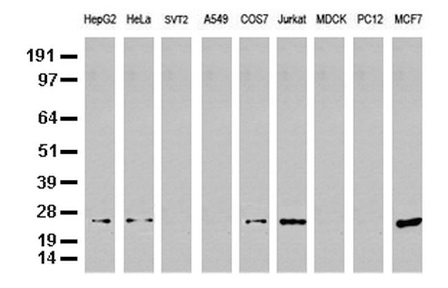 MGMT Antibody in Western Blot (WB)