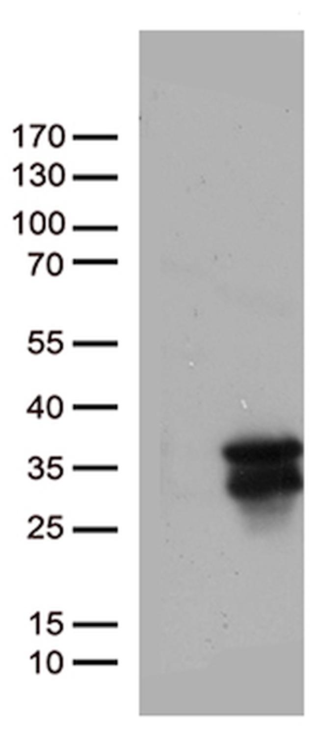 MGMT Antibody in Western Blot (WB)