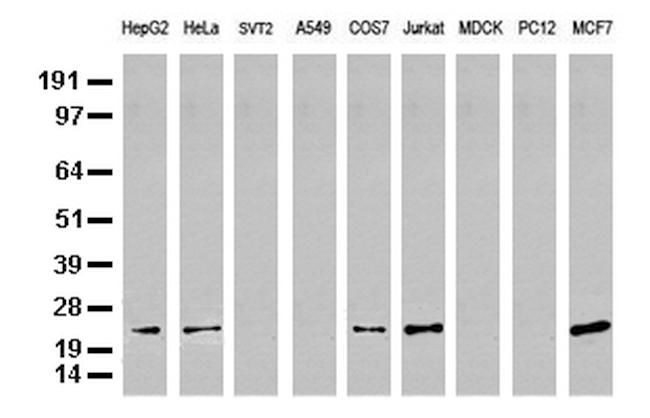 MGMT Antibody in Western Blot (WB)