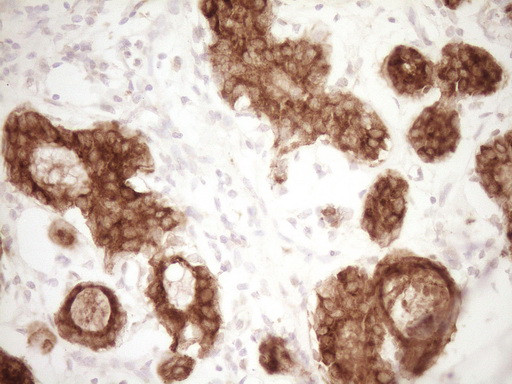 MGP Antibody in Immunohistochemistry (Paraffin) (IHC (P))