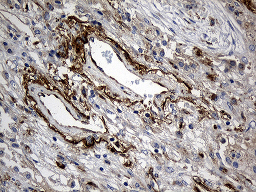 MGP Antibody in Immunohistochemistry (Paraffin) (IHC (P))