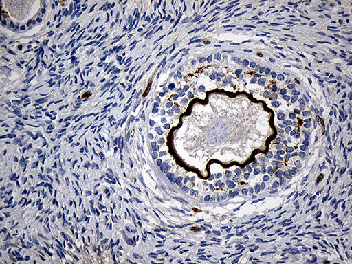 MGP Antibody in Immunohistochemistry (Paraffin) (IHC (P))