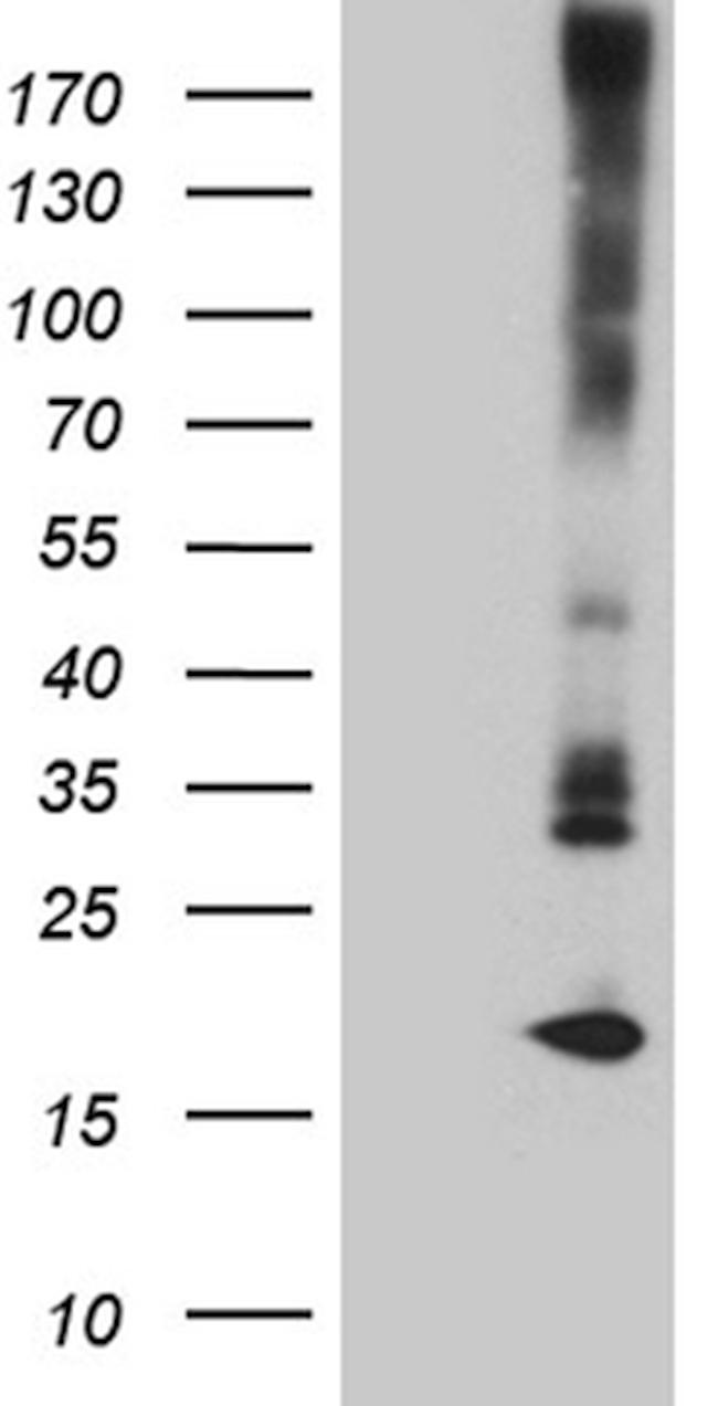 MGP Antibody in Western Blot (WB)