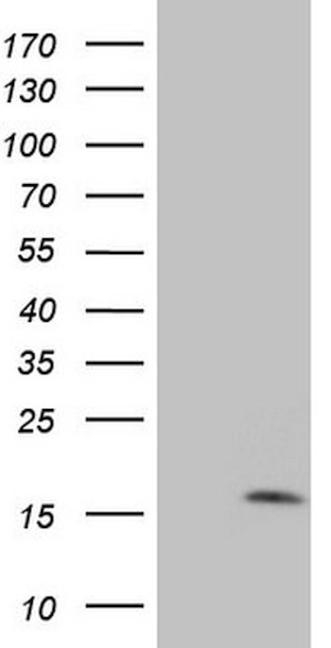 MGP Antibody in Western Blot (WB)