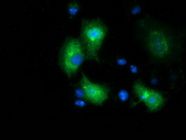 MGRN1 Antibody in Immunocytochemistry (ICC/IF)