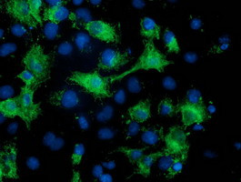 MGRN1 Antibody in Immunocytochemistry (ICC/IF)