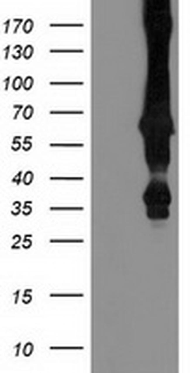 MGRN1 Antibody in Western Blot (WB)