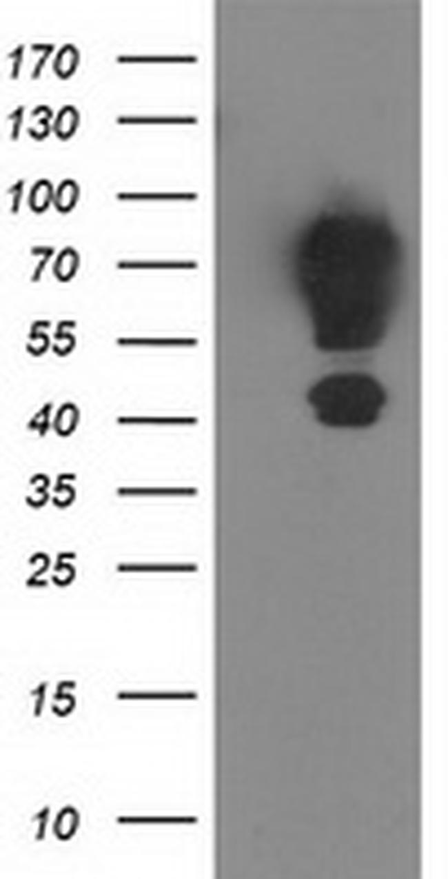MGRN1 Antibody in Western Blot (WB)