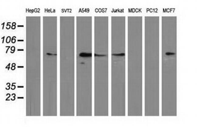 MGRN1 Antibody in Western Blot (WB)