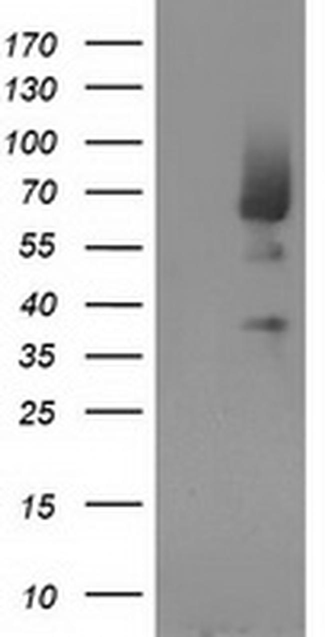 MGRN1 Antibody in Western Blot (WB)