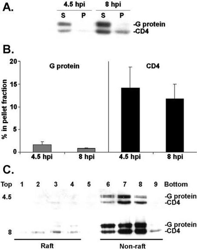 CD4 Antibody in Western Blot (WB)