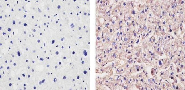 ApoA1 Antibody in Immunohistochemistry (Paraffin) (IHC (P))