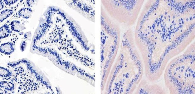 ApoA1 Antibody in Immunohistochemistry (Paraffin) (IHC (P))