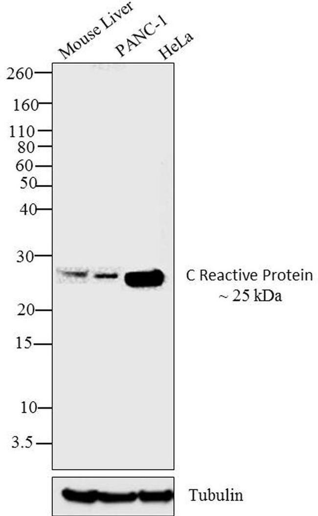 CRP Antibody in Western Blot (WB)