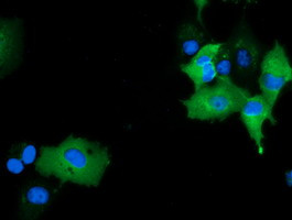 MICAL1 Antibody in Immunocytochemistry (ICC/IF)