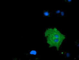 MICAL1 Antibody in Immunocytochemistry (ICC/IF)