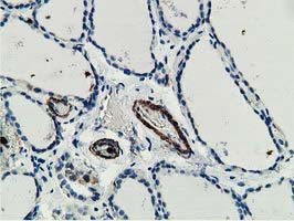 MICAL1 Antibody in Immunohistochemistry (Paraffin) (IHC (P))