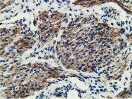 MICAL1 Antibody in Immunohistochemistry (Paraffin) (IHC (P))