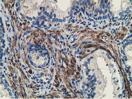 MICAL1 Antibody in Immunohistochemistry (Paraffin) (IHC (P))