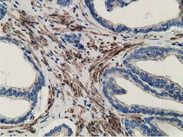 MICAL1 Antibody in Immunohistochemistry (Paraffin) (IHC (P))