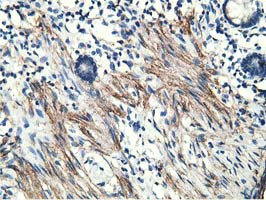 MICAL1 Antibody in Immunohistochemistry (Paraffin) (IHC (P))